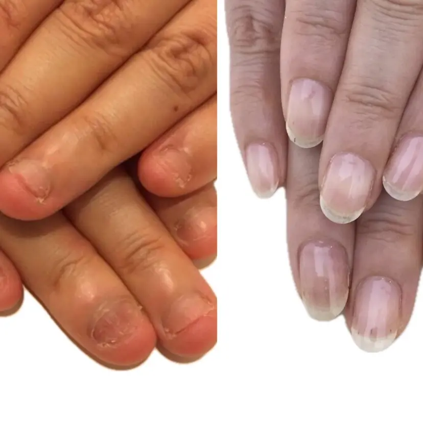 深爪矯正専門 ネイルサロンエルナの掲載