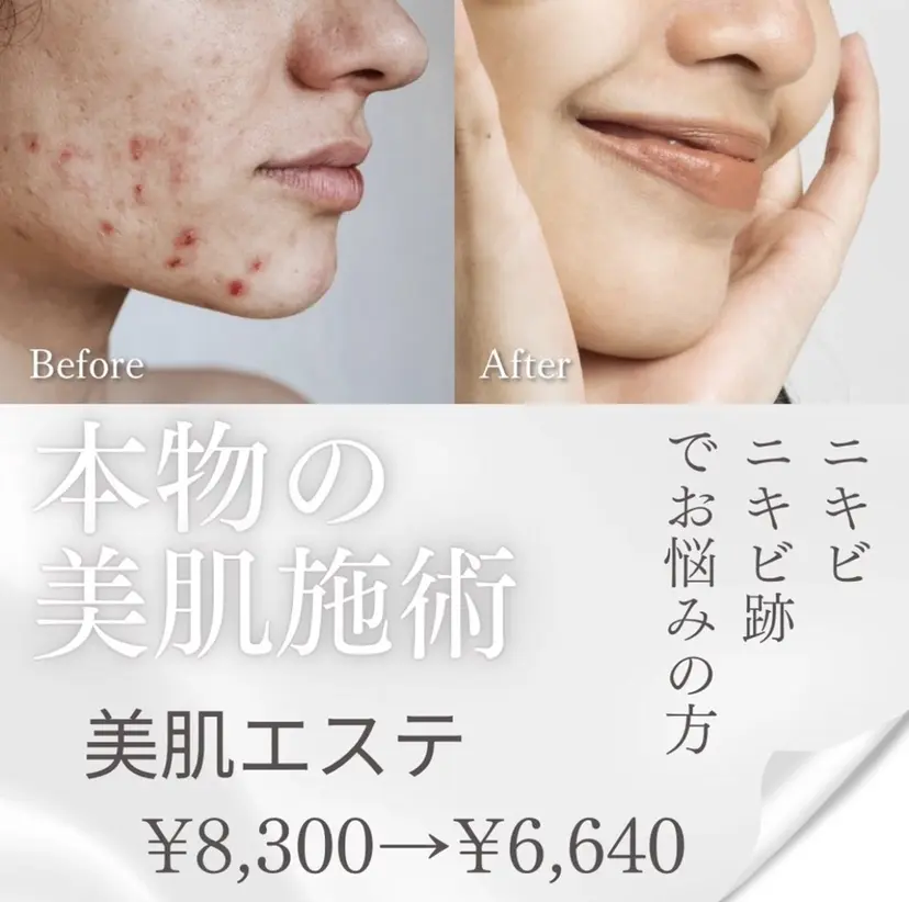 肌質改善・脱毛サロン Luangeの掲載