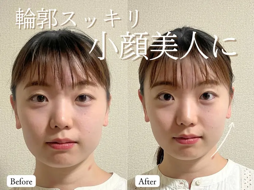 小顔整体×毛穴サロン DRRAMSPA町田の掲載