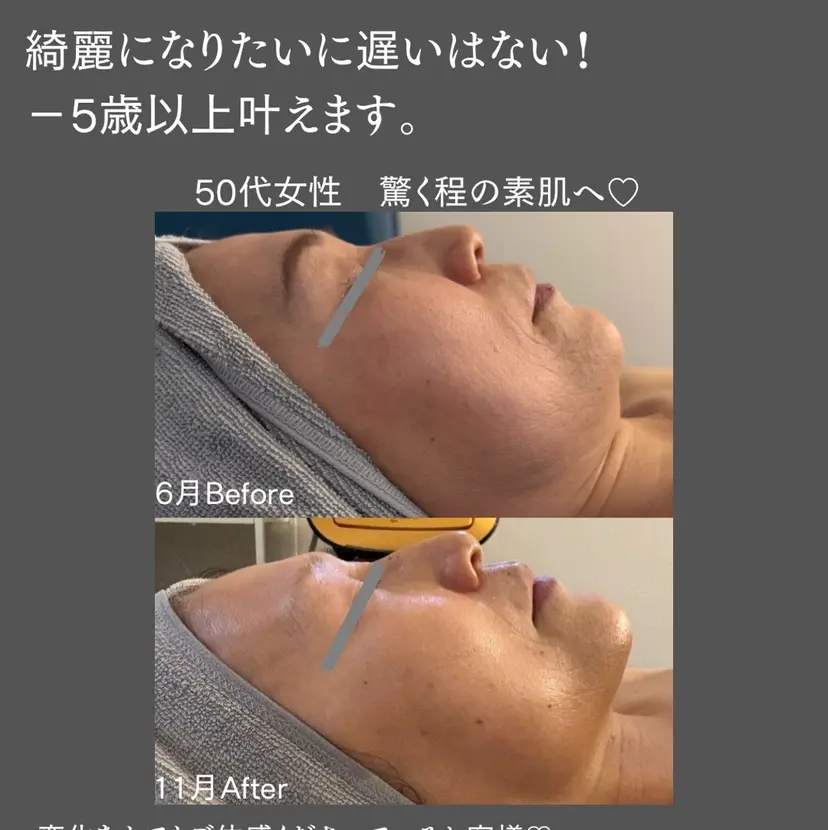 BLOSSOM 菊地の掲載