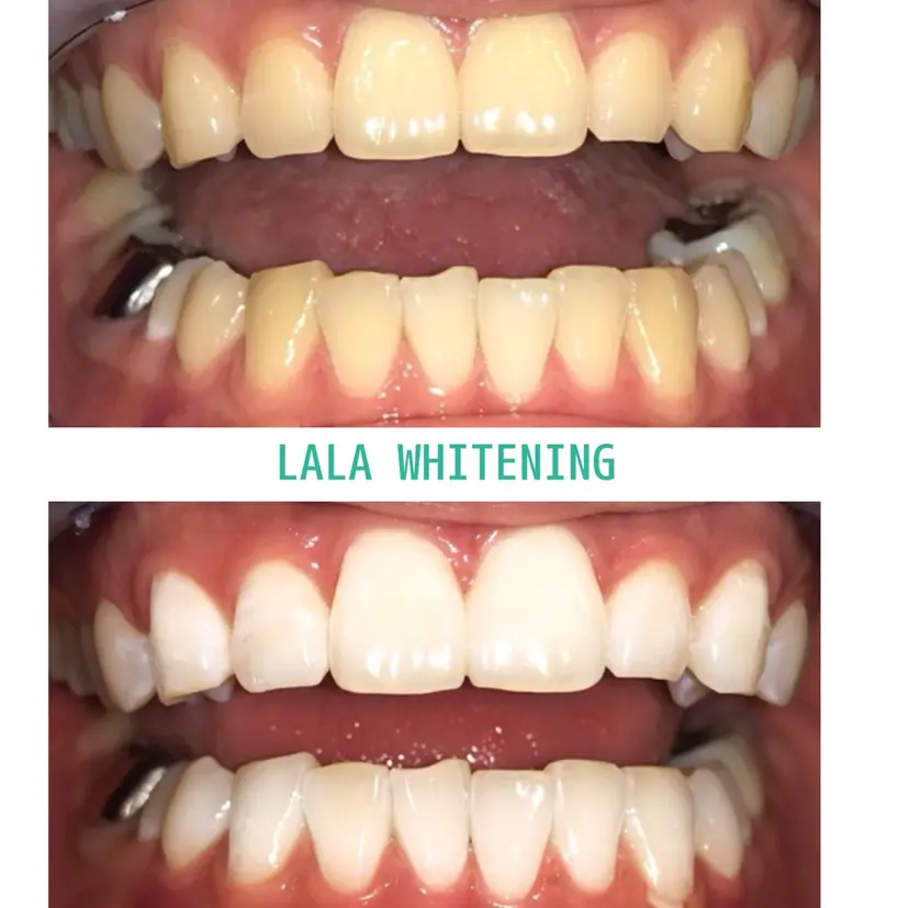 ララホワイトニング 大分駅前店の掲載