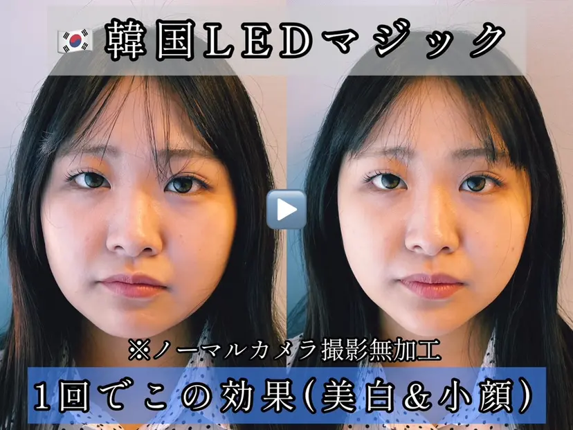 小顔美容鍼専門サロン 渋谷YZの掲載