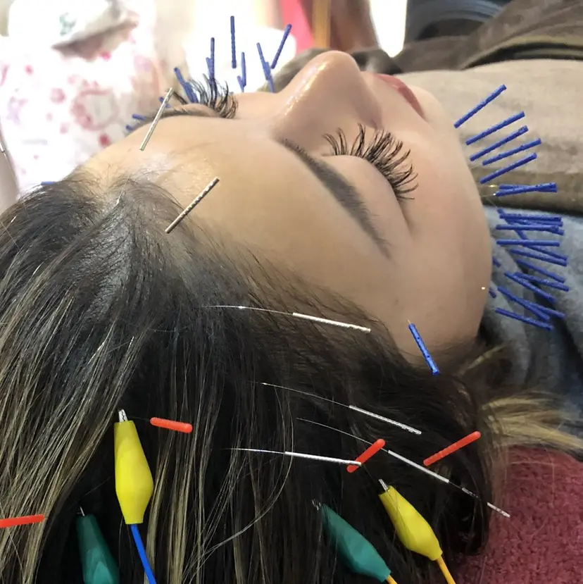 美容鍼灸女性専用 りんご鍼灸治療院の掲載