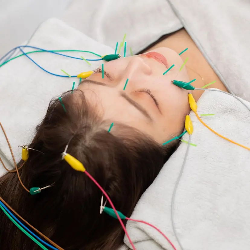 美容鍼hari-me 新宿の掲載