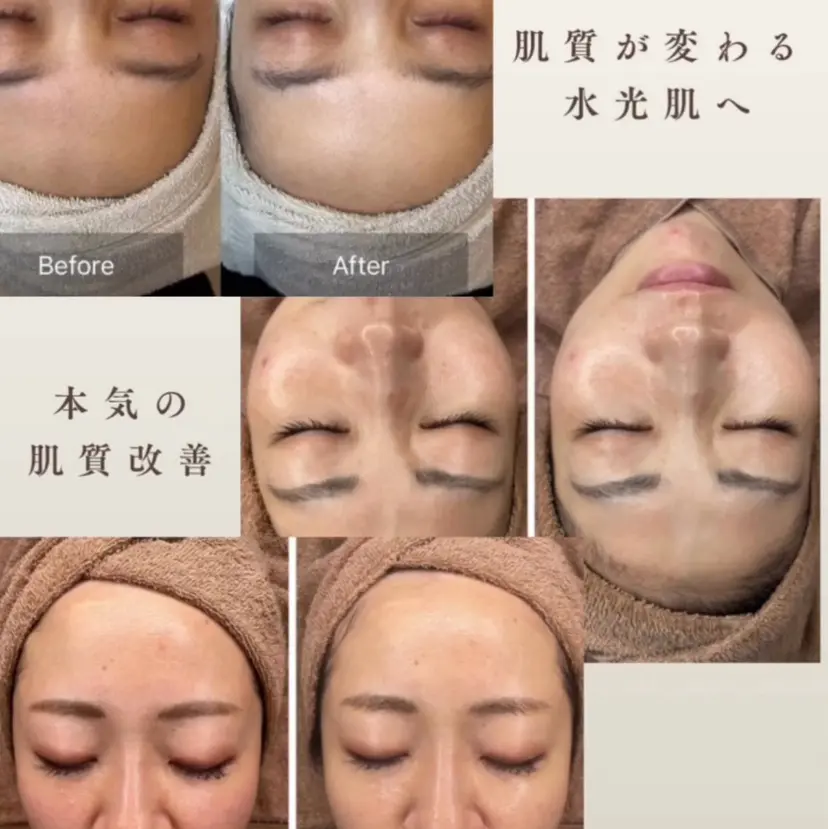 高知エステ yamaokaの掲載