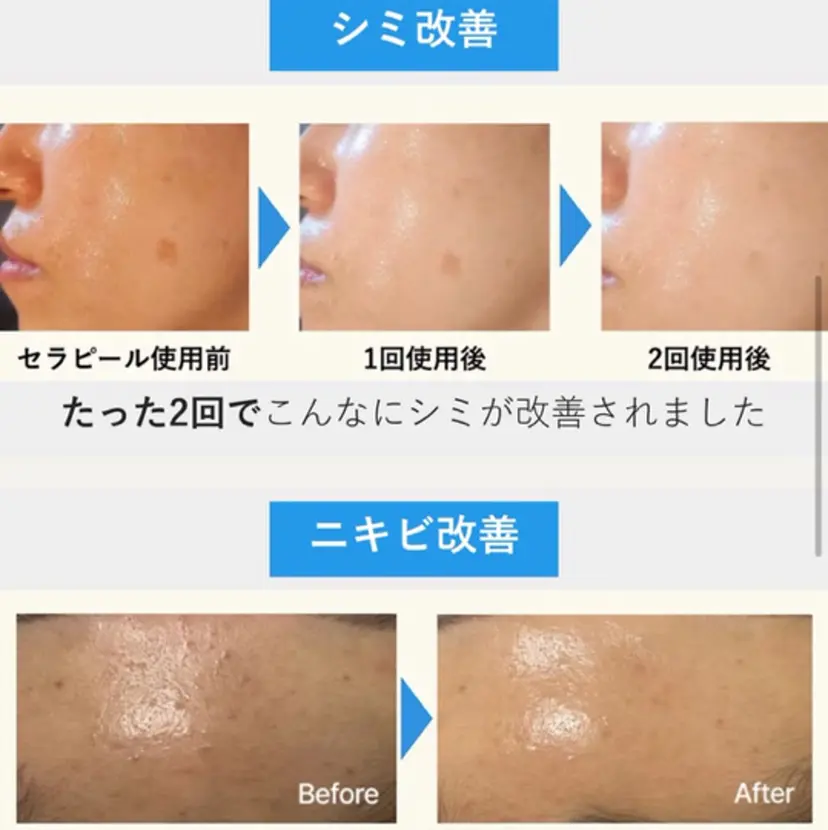 MUKU aiの掲載