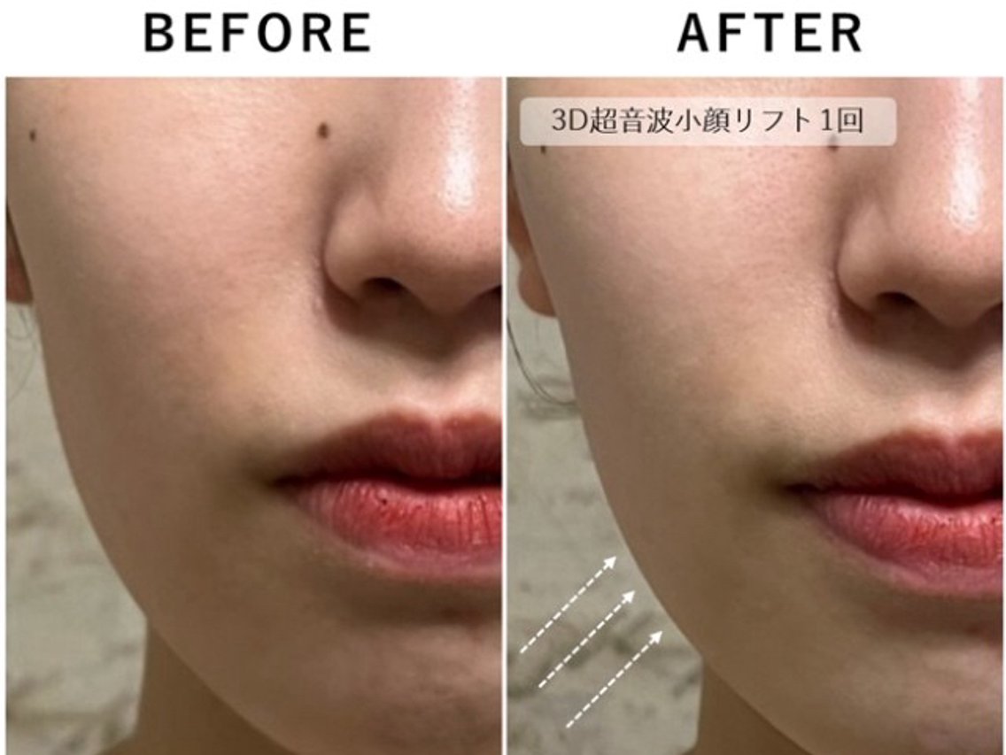 東京 × リフトアップ × エステ・リラクサロン お得に予約する