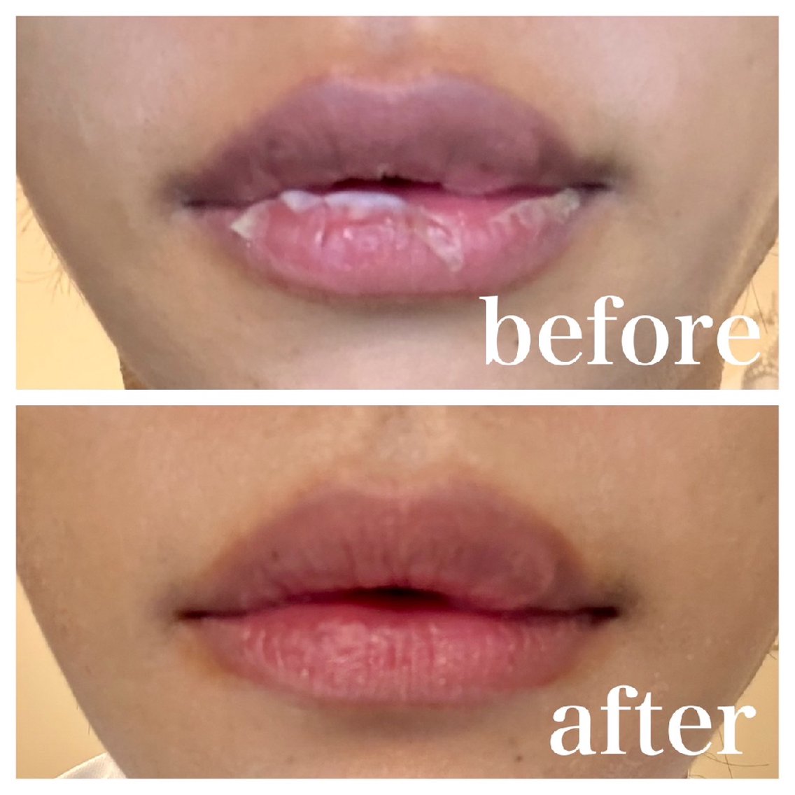 ローマピンクの1ヶ月後のビフォーアフターです。 上のお写真はローマ