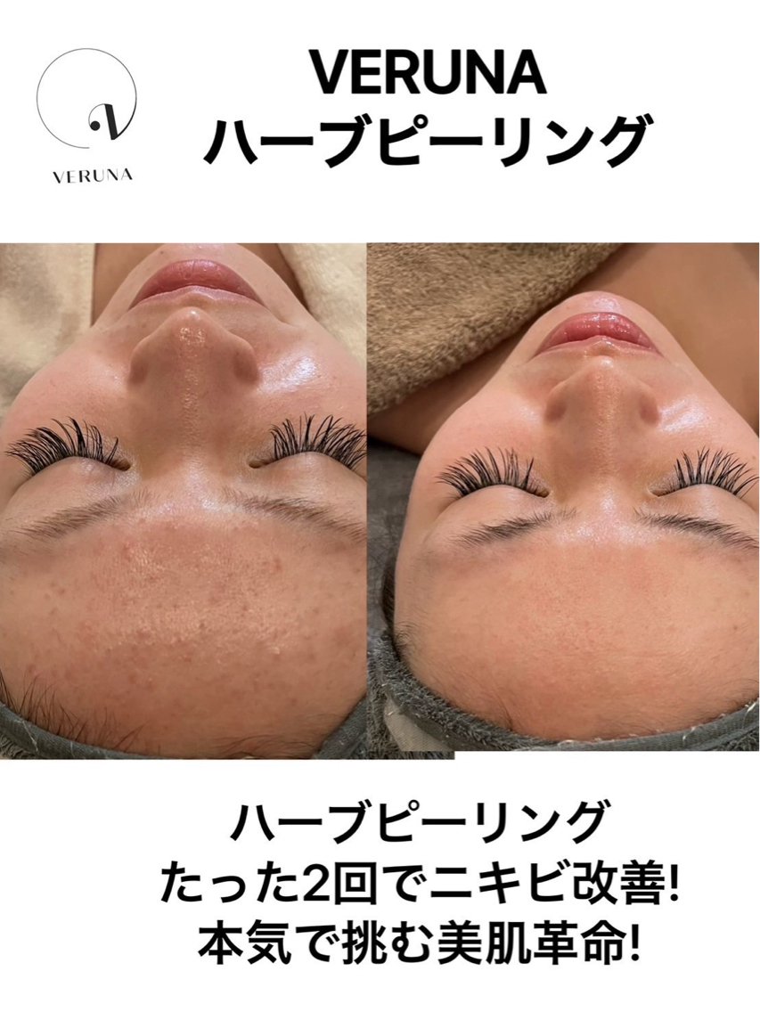 b3b7f0f391d14e8ffa3efc394b0259