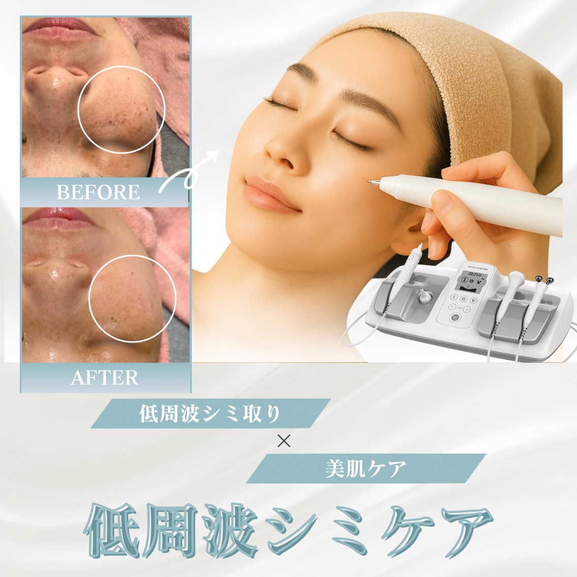 ✨️低周波顔シミ取りエステ✨️人気商品✨️即日発送 BestBelleꕤ 大阪福島/肌質改善(BestBelleビューティサロン所属)の