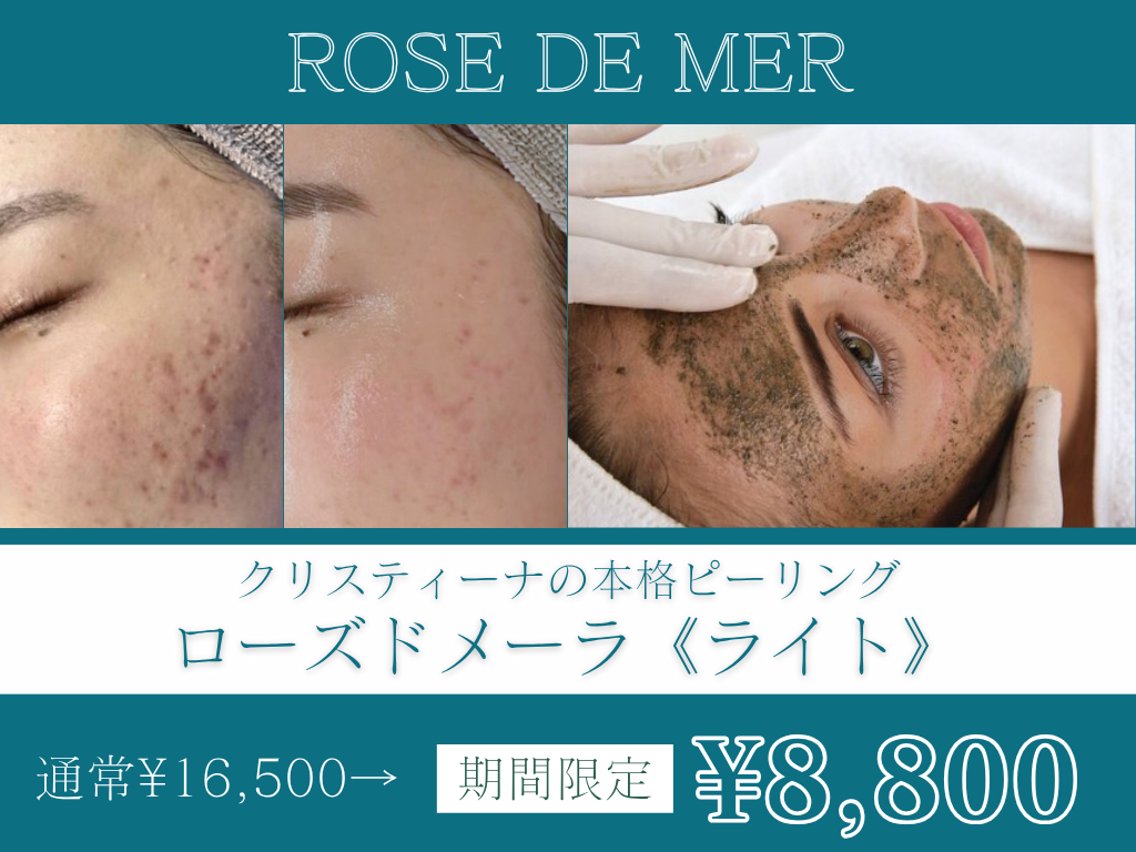 シミ取り|エステサロン |ハーブピーリング|美肌ケア|シミケア|剥離あり