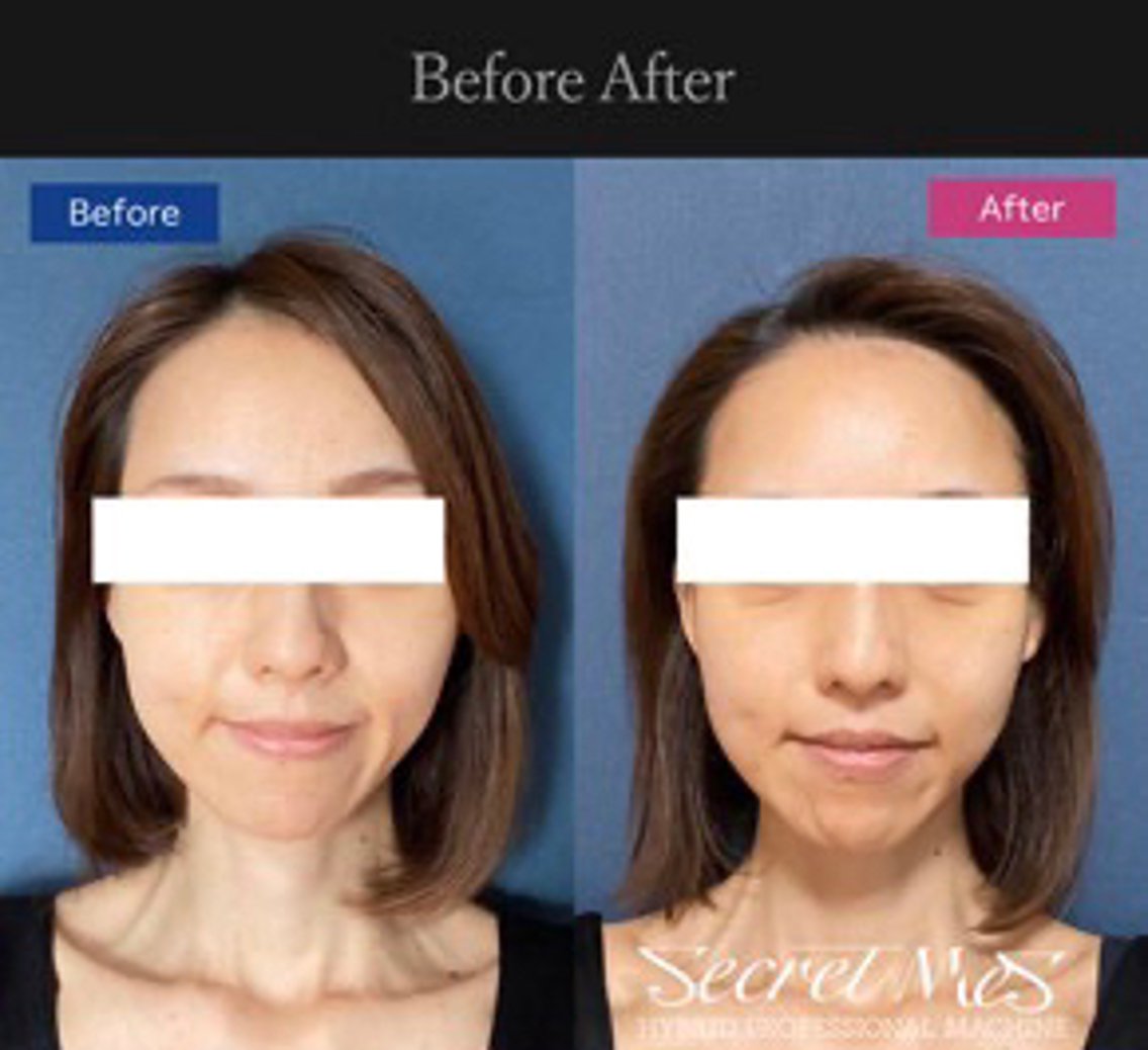 c9fcbaeaa753707964cbff6d33a1f0