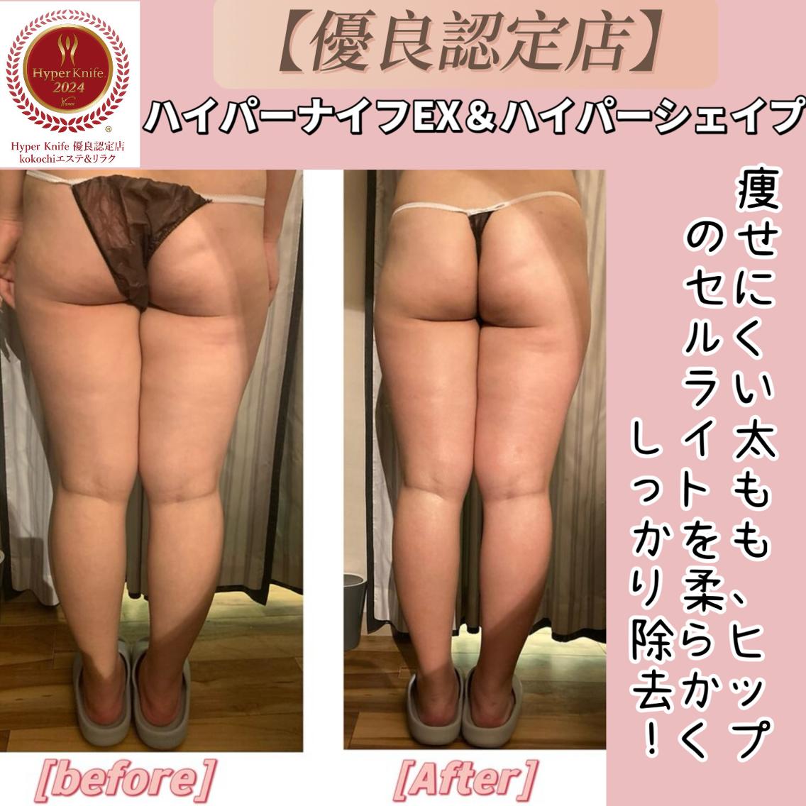美肌小顔コルギ&瘦身 KOKOCHI(ハイパーナイフEX痩身&小顔コルギKOKOCHI