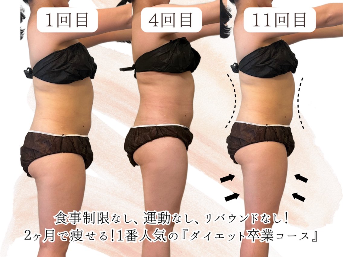 目黒】本格痩身︎ 最新型よもぎ蒸しのプロフィール・予約(【本格痩身