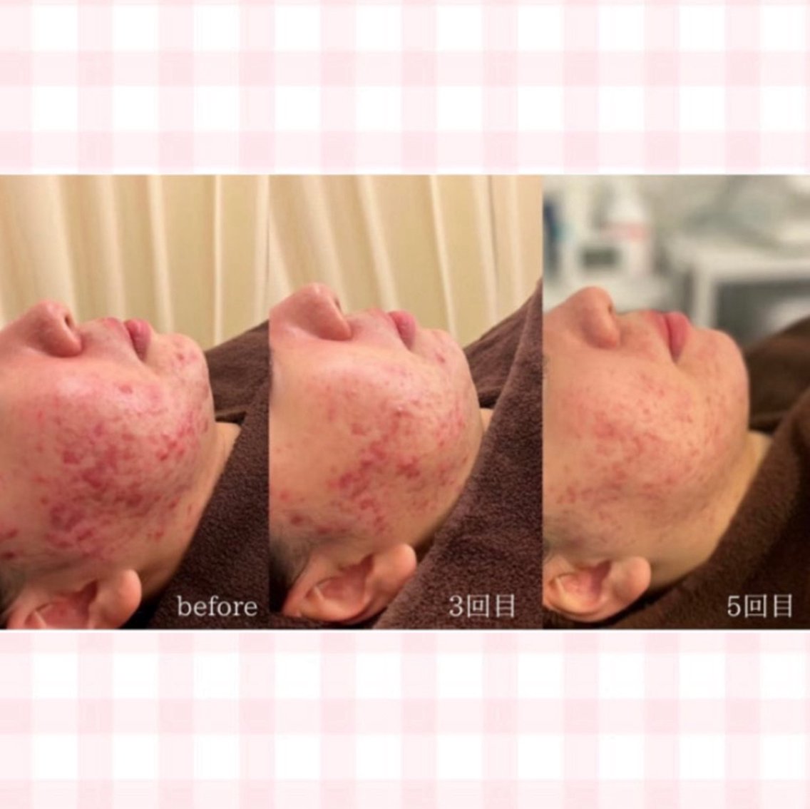 00b8396d3a8b0045be63bd70adca3f