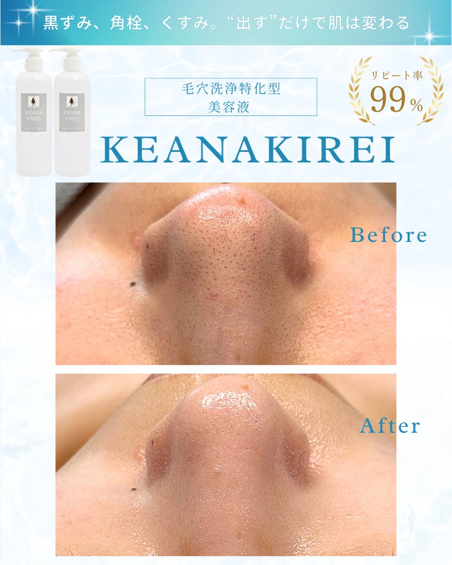 レモンボトル脂肪分解×3D小顔×ララピール レモンボトル脂肪分解 脂肪