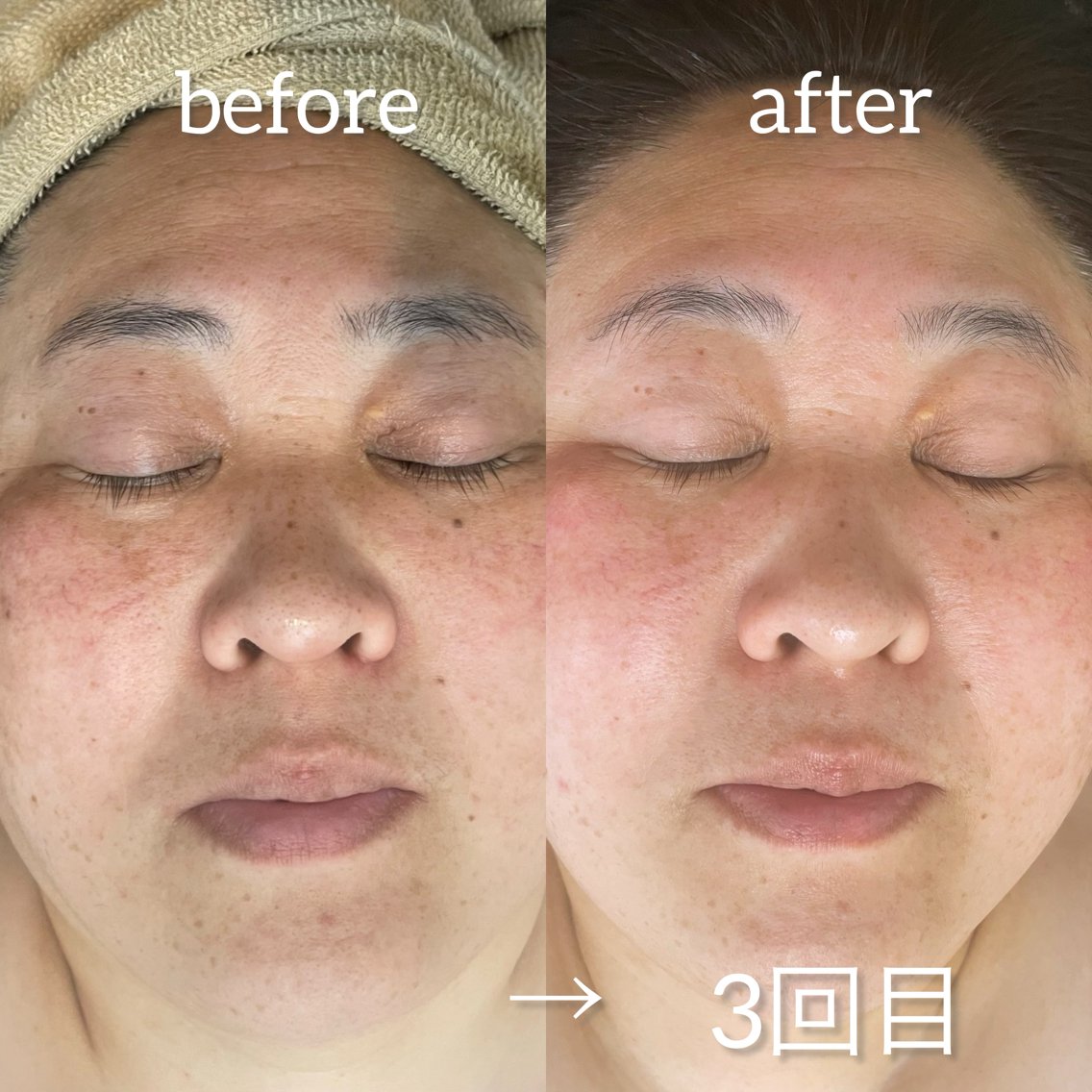 7ccc72b9babb0f74a79e914895e651