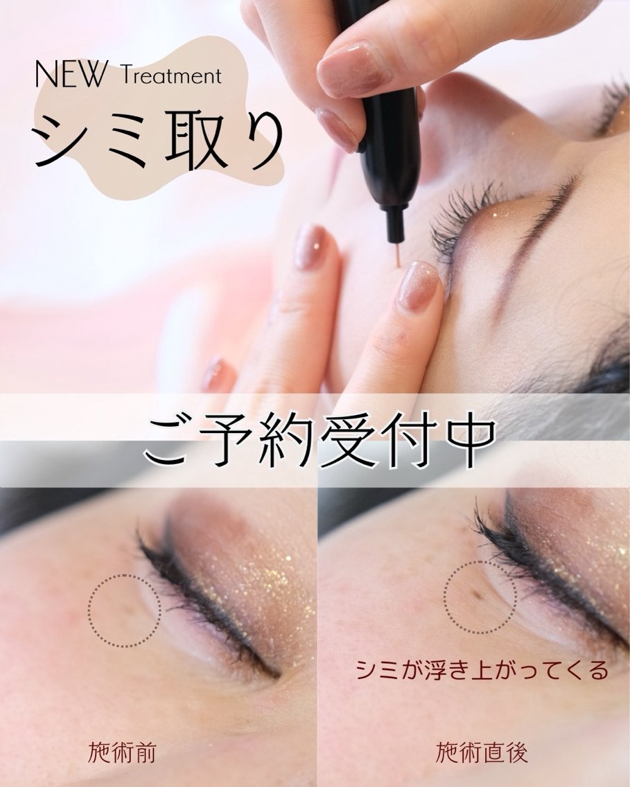 ︎✿mime‪✿新品美品完売品最安値‪✿ ⭐︎3in1シミケアエステ 28409eaa032952441c265ee47a2d56