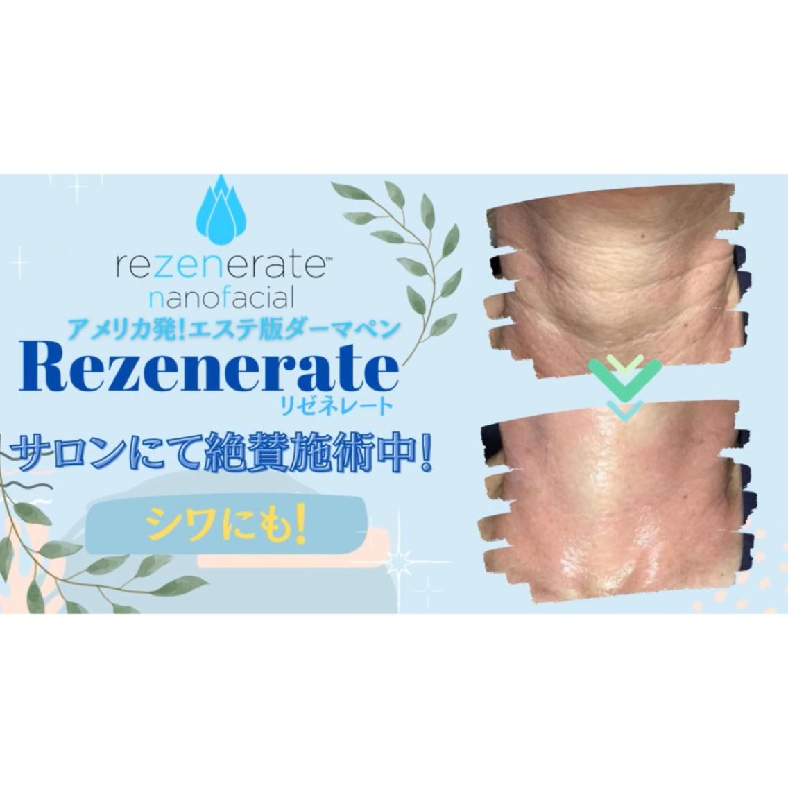ダーマペン リゼネレート 出血なし 大人気 特別価格一台⁉️ 【公式通販】