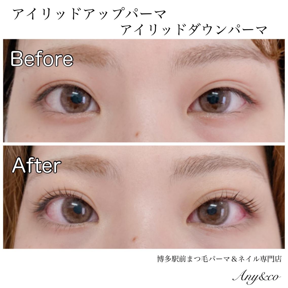 上アイリットアップパーマ アイリッドアップパーマで瞼が上がり、まつ毛も上向に｜merveilles所属