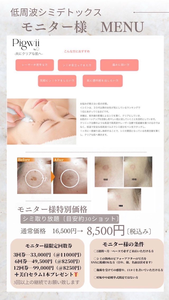美容サロンカタログカタログ「低周波シミケアマシン