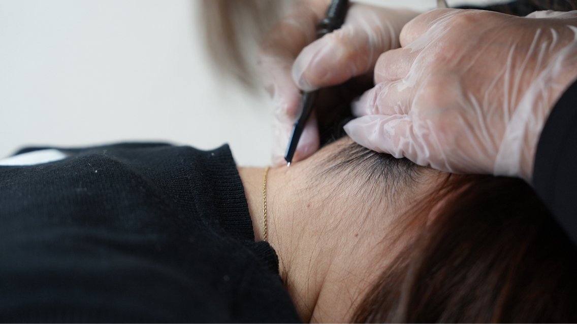 魔法の痩身ジェル＝針無し脂肪溶解ジェルはクリニックで大人気の脂肪