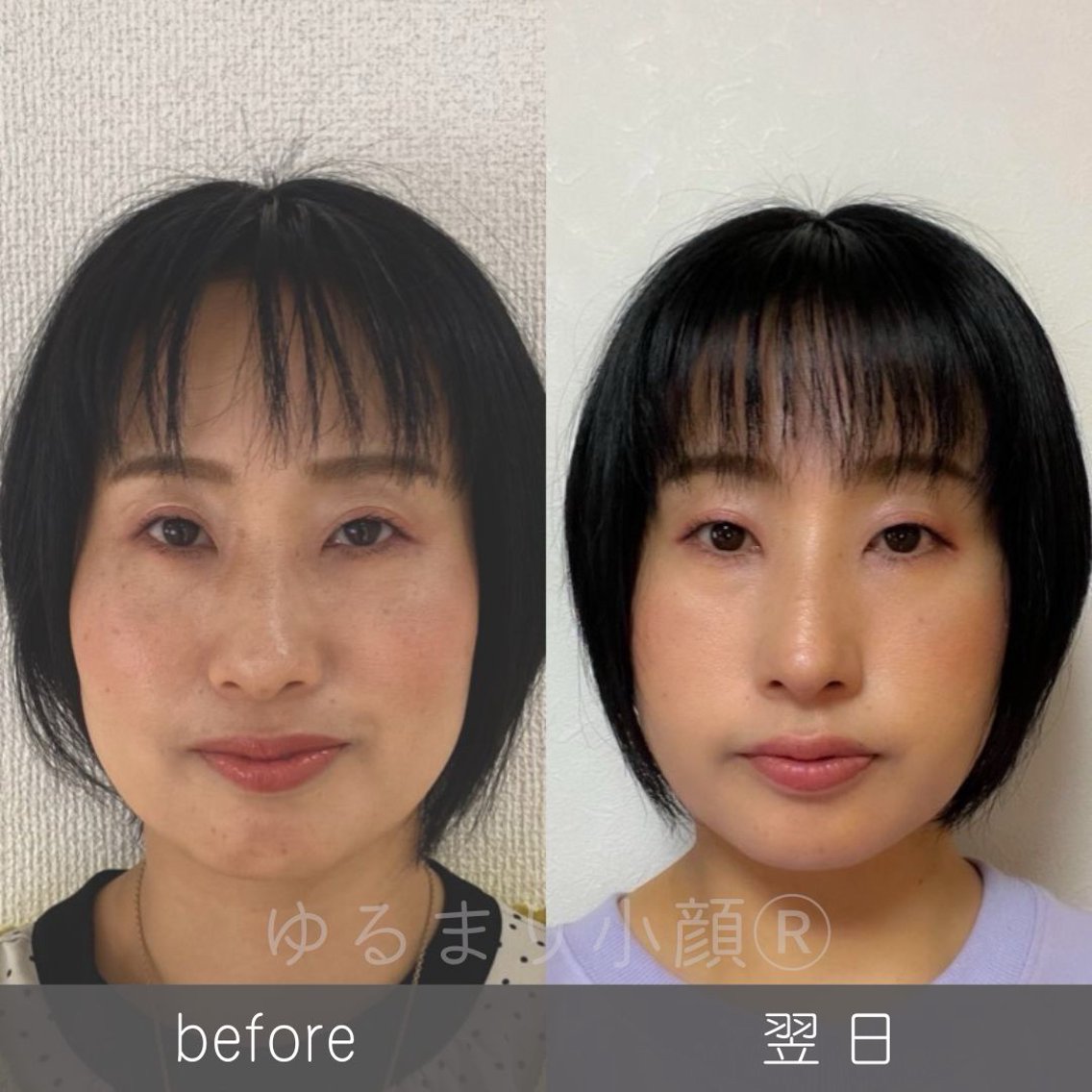 S-Style 小顔・美顔矯正 DVD 小顔矯正サロン町田 逸見智美(kanon〜カノン〜所属)のメニュー｜ミニモ