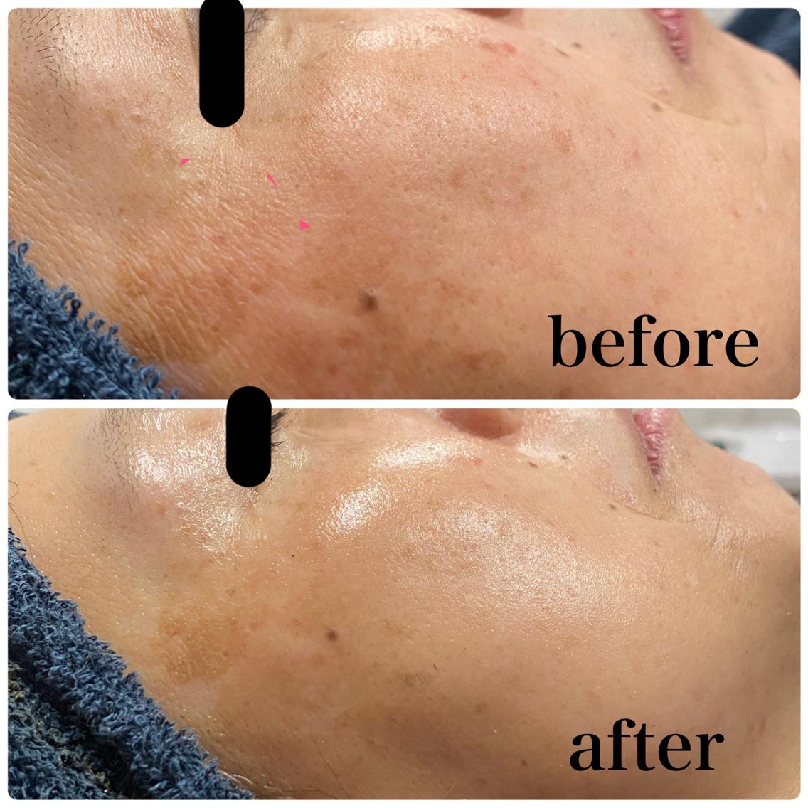 b246f6659b5827454a8f86104d6b6f