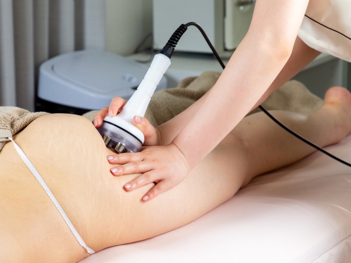 大阪府でセルライト除去のおすすめエステ・リラク＆人気