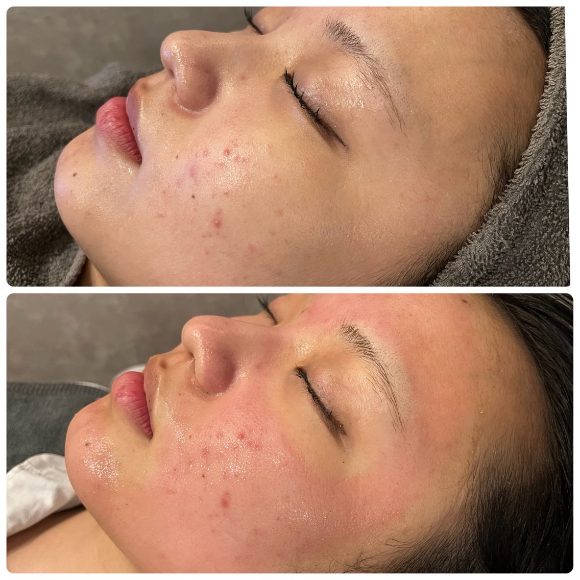 80d95e4d34bf830a33355d884b4241