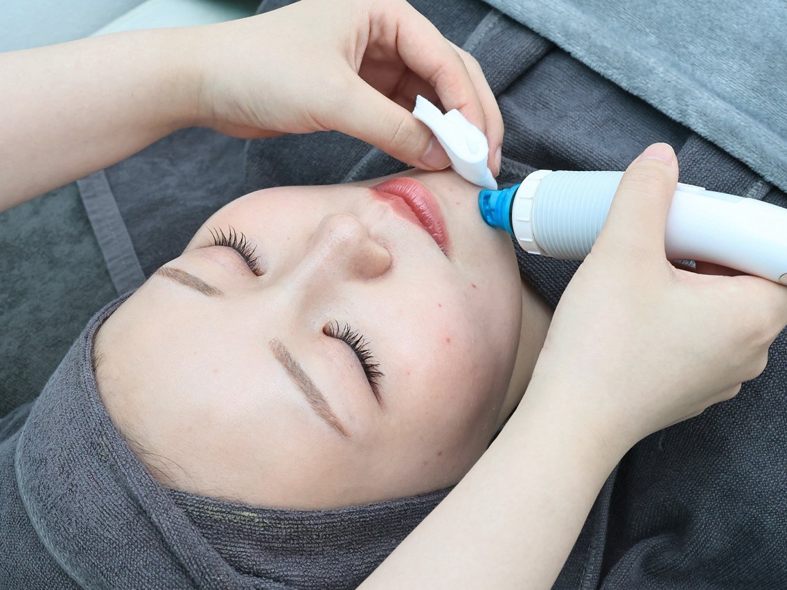 ニキビ・毛穴・肌荒れ ララピール×LDM(ニキビケア・毛穴洗浄専門店