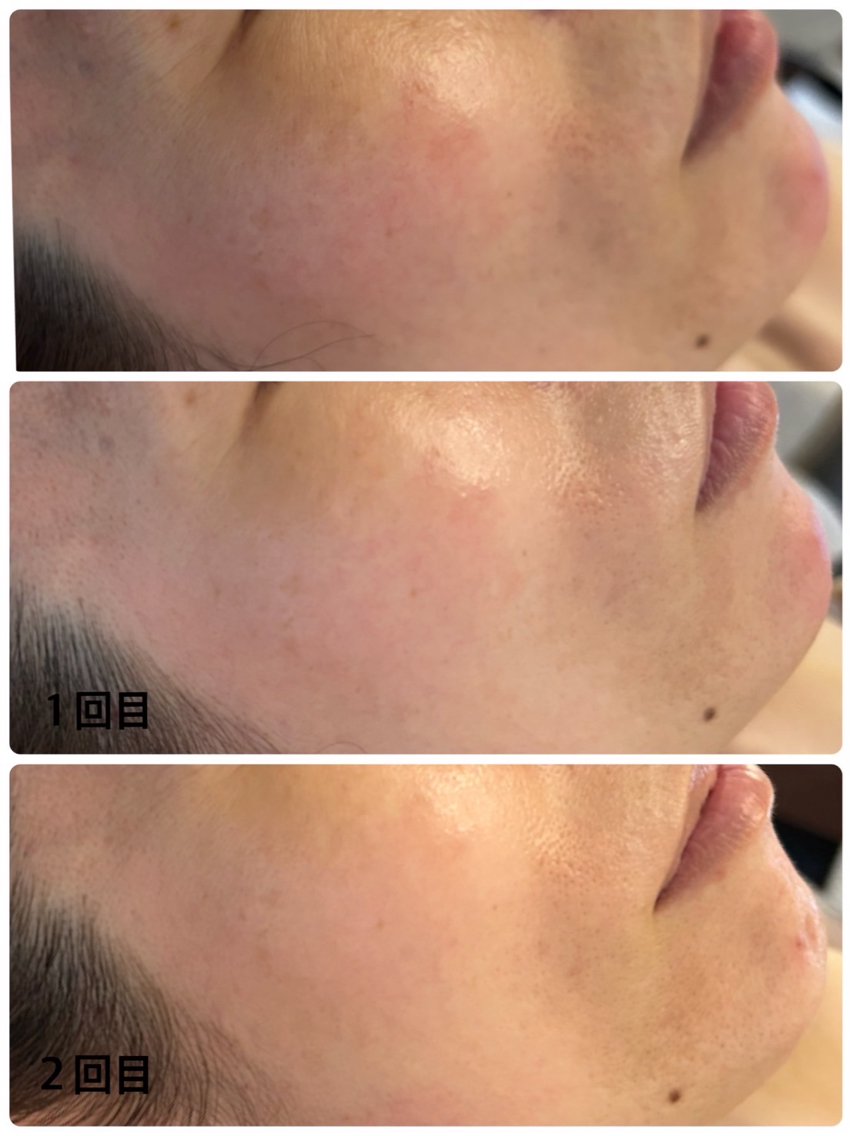 19349b80bf6a9afc7db164533cffb1