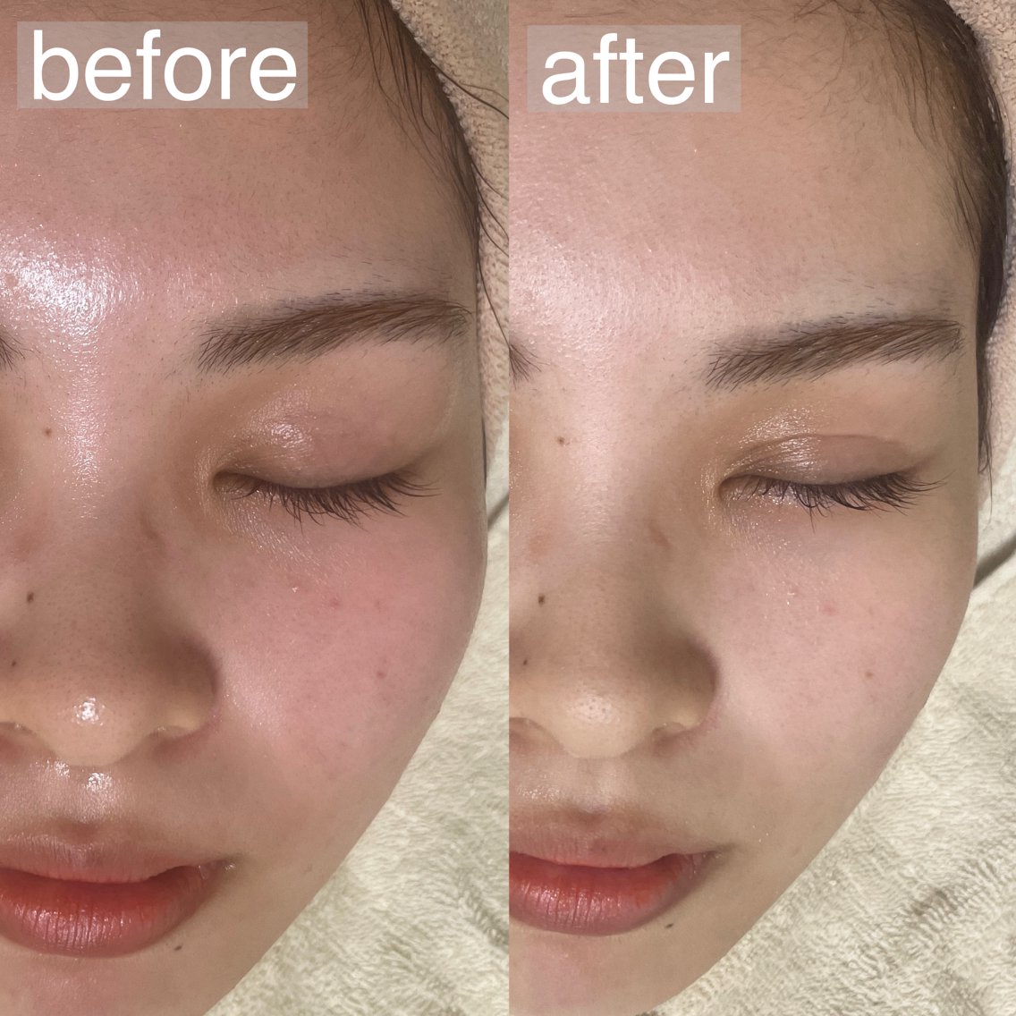 アイブロウ&フェイシャルサロンa'lm所属・WAX脱毛/肌質改善 眉毛とお肌