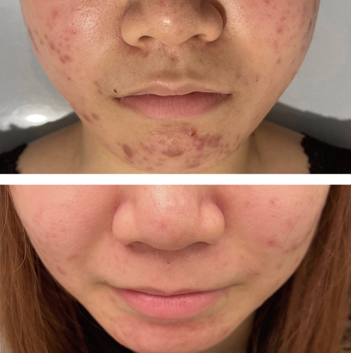 ROOレモンボトル　最新ララピール ララピール+レモンボトルメニューです ｜肌管理/ナスサロ ིྀmarina