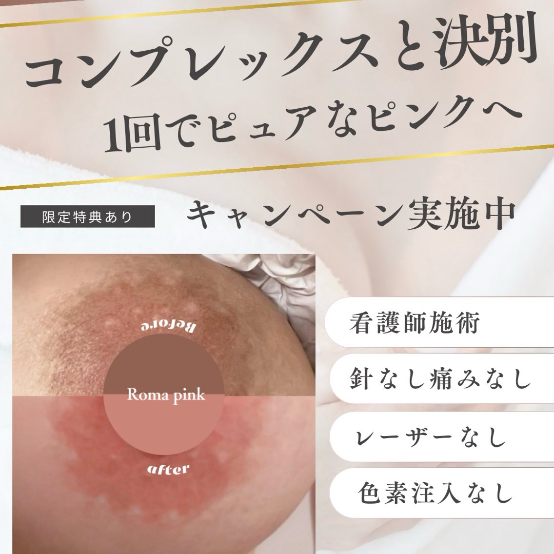 ローマピンク症例 人には言えないお悩み。出産や年齢とともに蓄積するメラニン。レーザーやハイドロキノ｜看護師  AYUI(小顔・肌質改善専門看護師クリニカルサロンBella所属)のエステ・リラクフォト(20250418194828)｜ミニモ