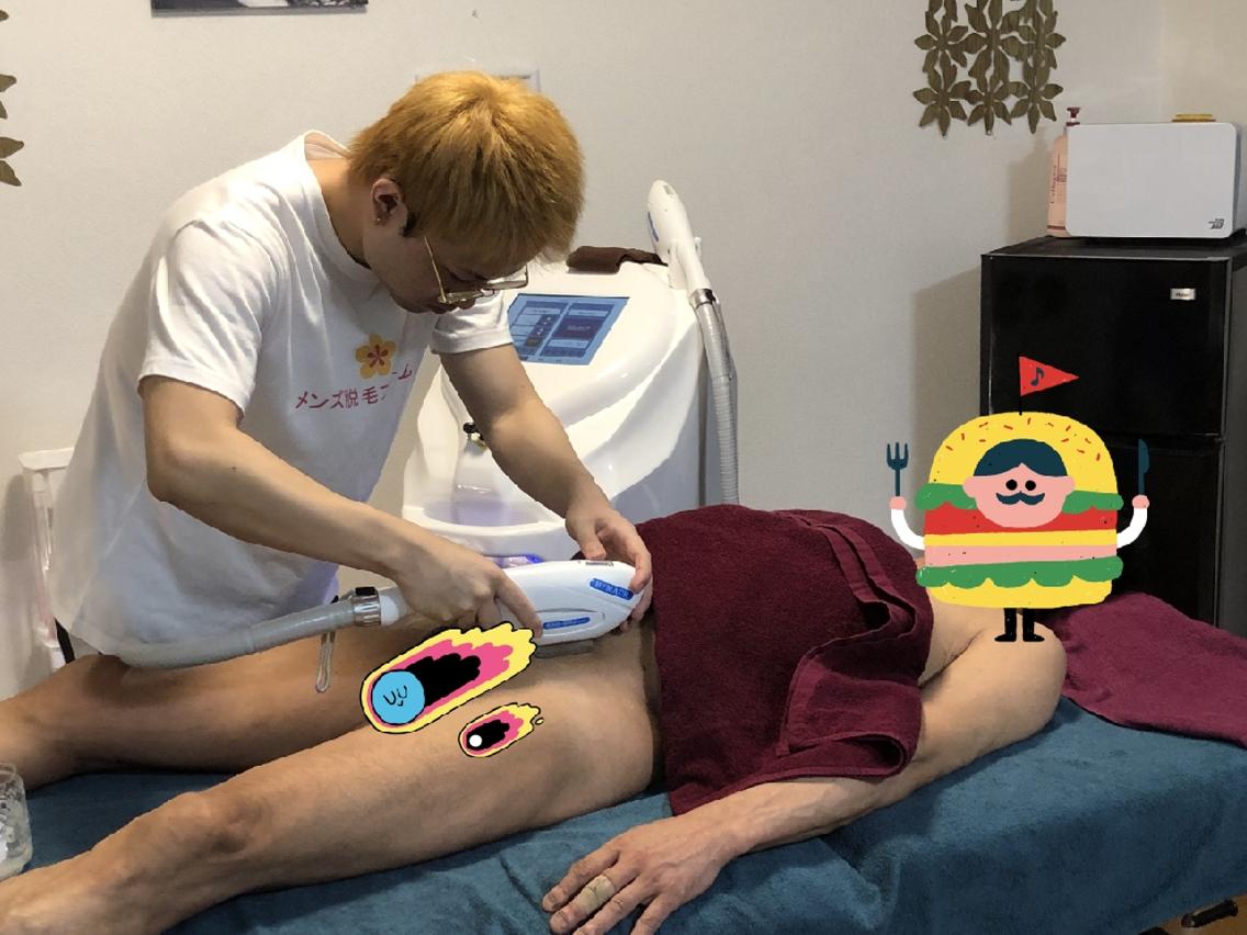 これまでで最高のメンズ Vio 脱毛 自由 髪型 コレクション