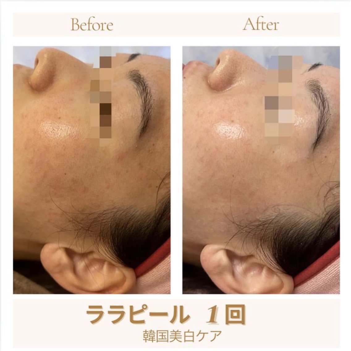 ララピール+レモンボトルメニューです ｜肌管理/ナスサロ