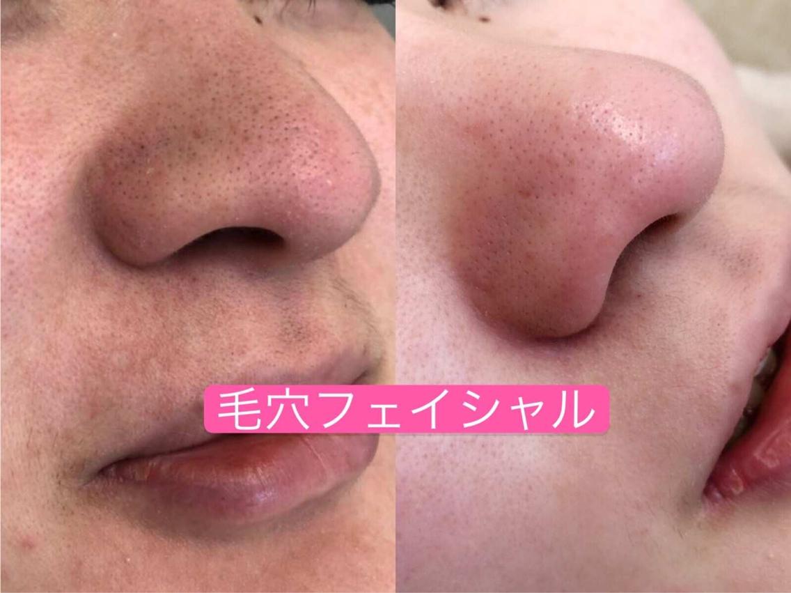 6cc54ea94c024ca4bba50006961e86