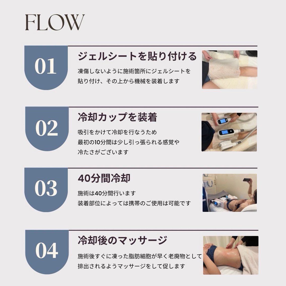 施術の流れについて 1.施術箇所にジェルシートを貼ります 2.冷却カップ