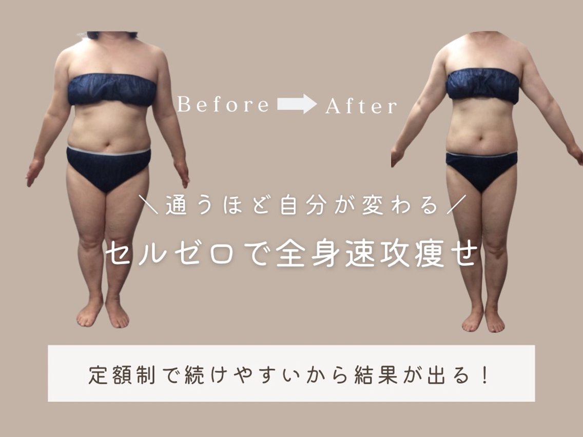月額制痩身エステ エスプライザの口コミ・評判(エスプライザ鹿児島