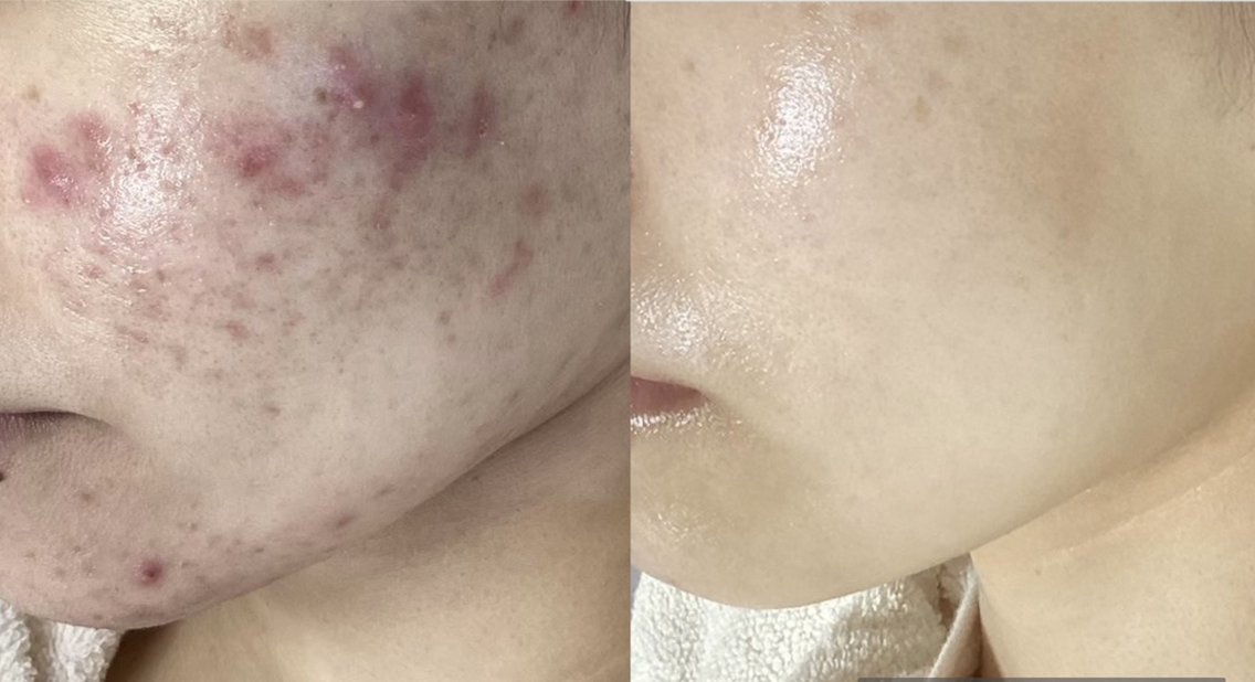 fabf05f982f17faddfaeec814817f8