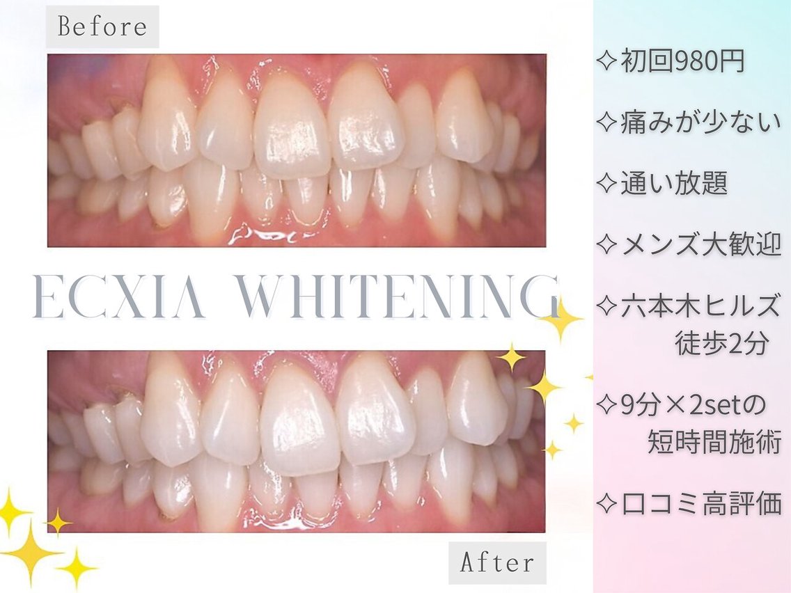 セルフホワイトニング エクシア六本木店(セルフホワイトニングサロン