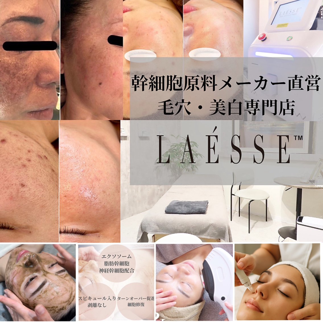 3日間限定値下げ！美顔器❤️エステサロン LAESSE 恵比寿所属・毛穴と美白の専門店 LAESSE 恵比寿のエステ