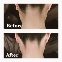 東京 シェービング エステ リラクサロン お得に予約するなら ミニモ