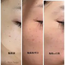 岡山 フェイシャルエステ エステ リラクサロン お得に予約するなら ミニモ