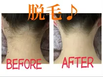 愛知県 脱毛 エステ リラクサロン お得に予約するなら Minimo ミニモ