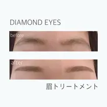 北千住駅 エステ リラクサロン お得に予約するなら ミニモ