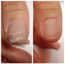 宇都宮市 ネイルサロン お得に予約するなら ミニモ