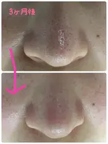 名古屋市 毛穴ケア エステ リラクサロン お得に予約するなら ミニモ