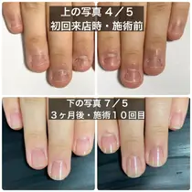 国分寺市 ネイルサロン お得に予約するなら ミニモ 国分寺市 ネイルサロン お得に予約するなら ミニモ